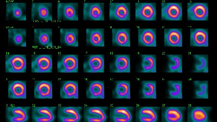 Landing_page_Cardiac