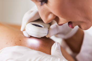 Skin Procedures Overview