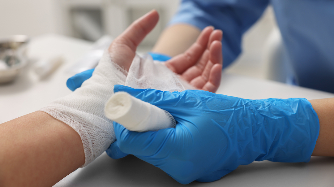 close up photo of a healthcare professional's blue gloved hands bandaging the hand of a patient.